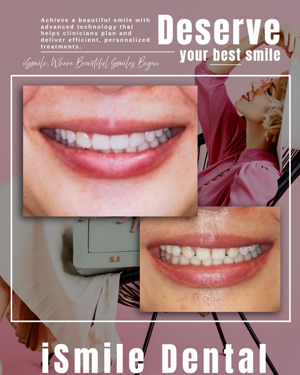 iSmile Dental Group | Dental Bridges, Dental Sealants and Teeth Whitening