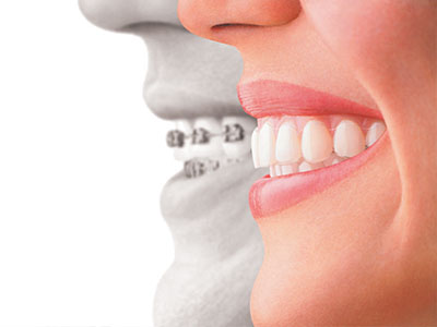 iSmile Dental Group | Cosmetic Dentistry, Teeth Whitening and Dental Cleanings