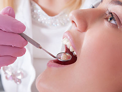 iSmile Dental Group | Implant Dentistry, Dentures and Root Canals