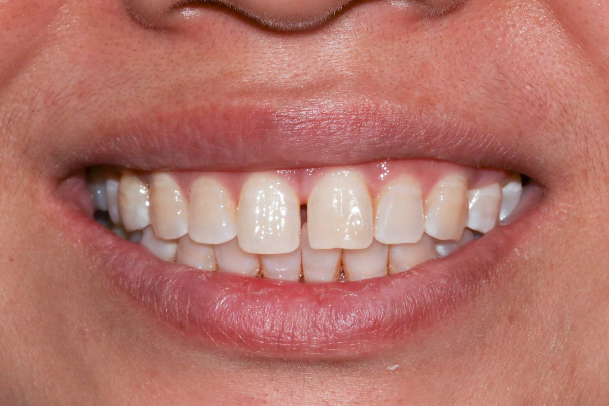 iSmile Dental Group LLC iSmile Dental Group LLC