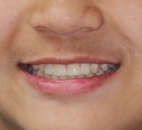 iSmile Dental Group LLC iSmile Dental Group LLC