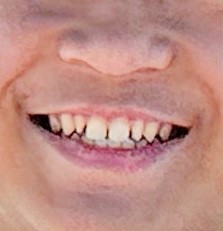iSmile Dental Group LLC iSmile Dental Group LLC