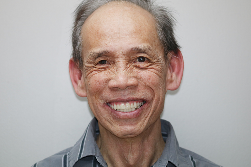 image of old man before treatment image of old man before treatment