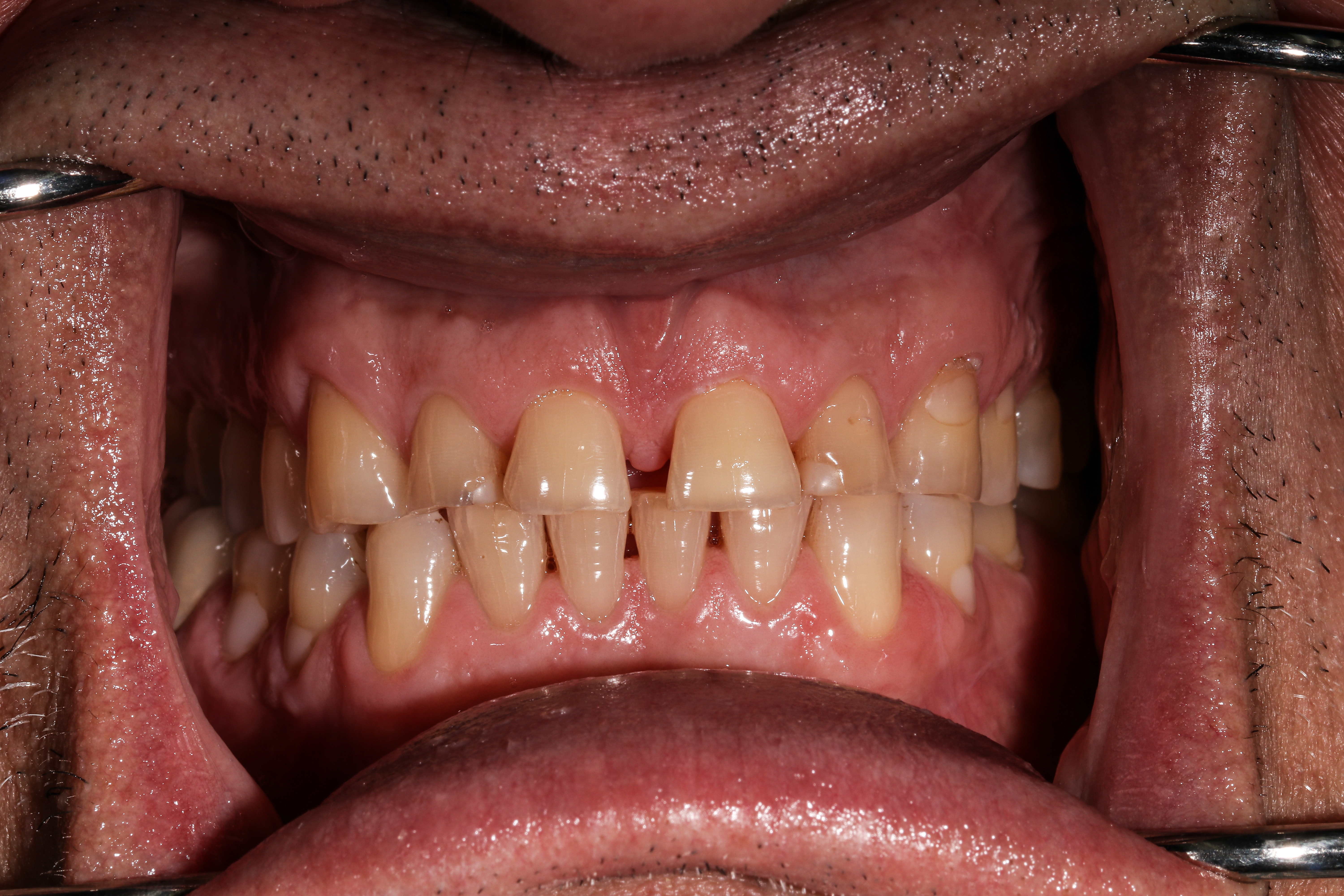 iSmile Dental Group LLC