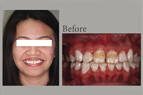 iSmile Dental Group LLC iSmile Dental Group LLC