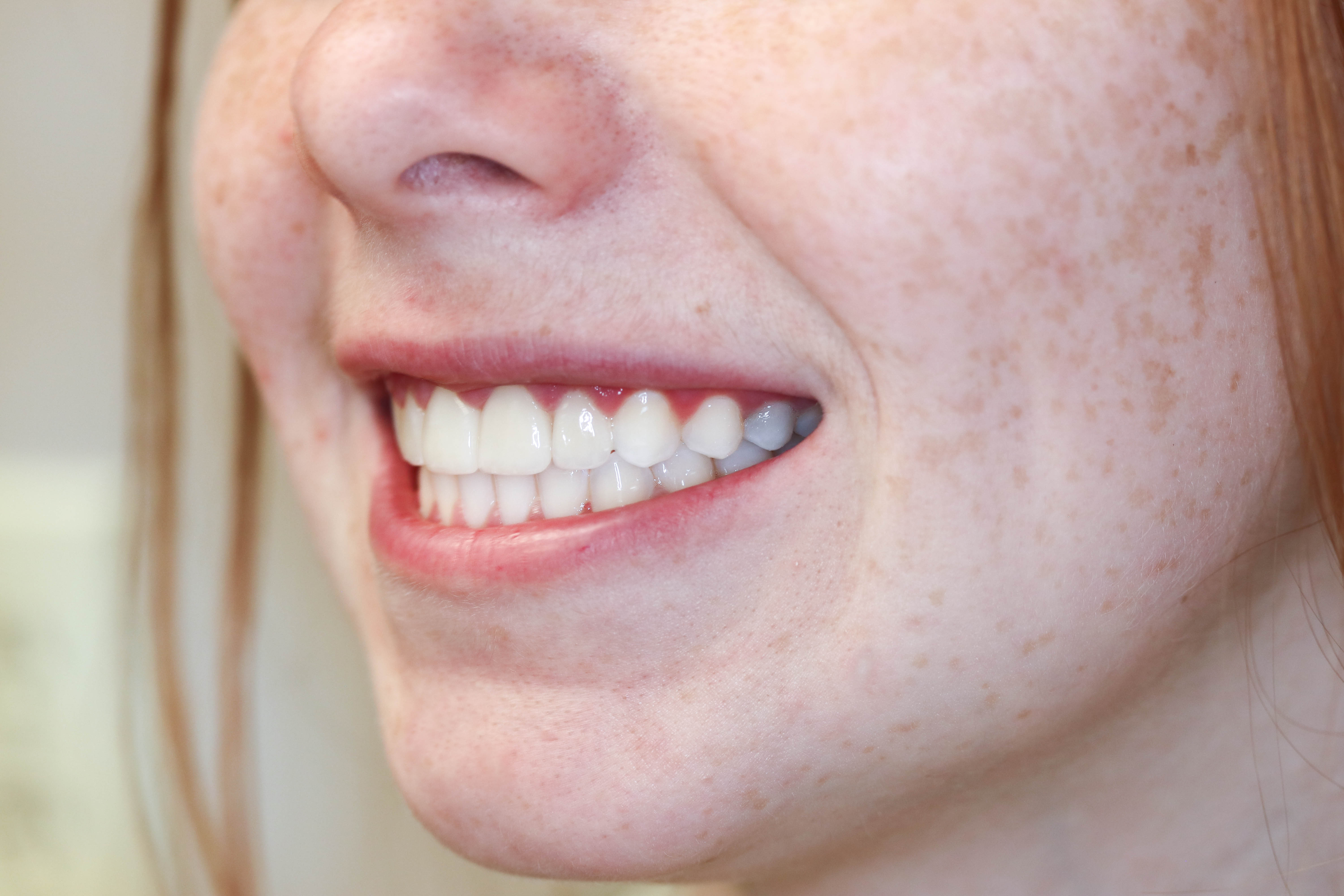 iSmile Dental Group LLC iSmile Dental Group LLC
