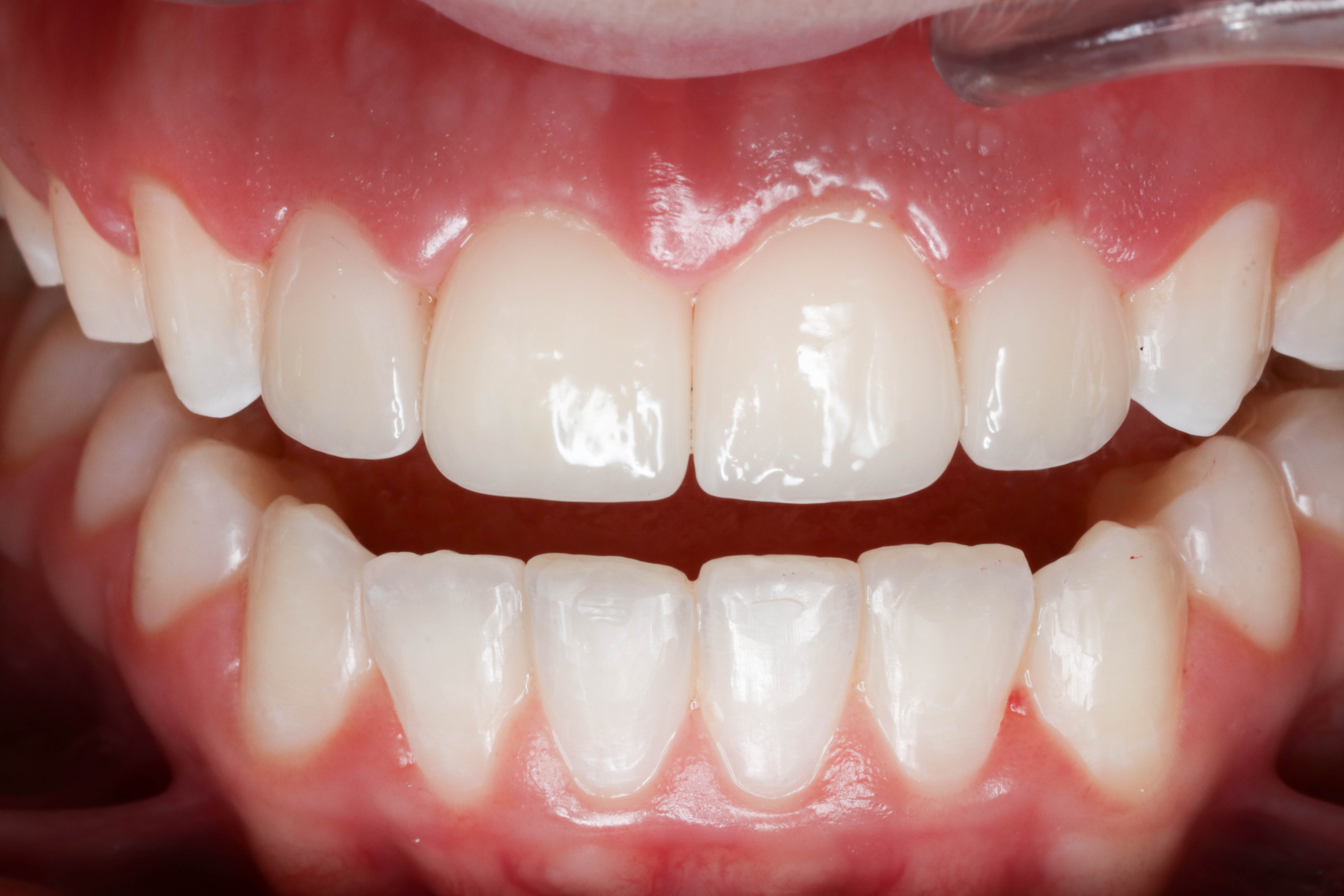 iSmile Dental Group LLC iSmile Dental Group LLC