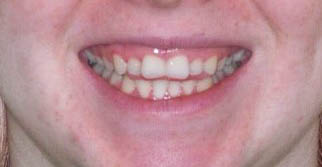 iSmile Dental Group LLC iSmile Dental Group LLC