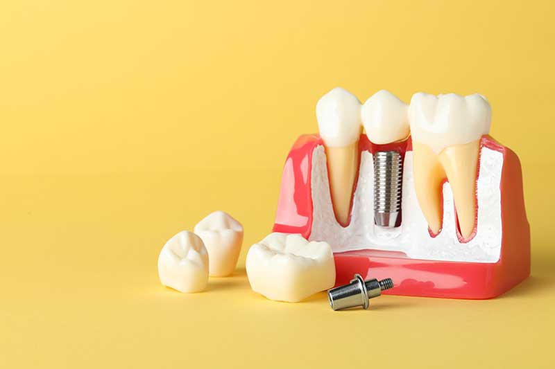 iSmile Dental Group LLC iSmile Dental Group LLC