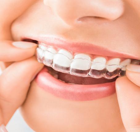 Orthodontics Orthodontics