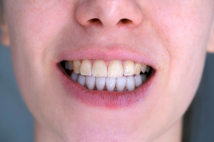 iSmile Dental Group LLC iSmile Dental Group LLC
